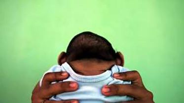Zika, Spain, microcephaly, Zika microcephaly birth, Europe