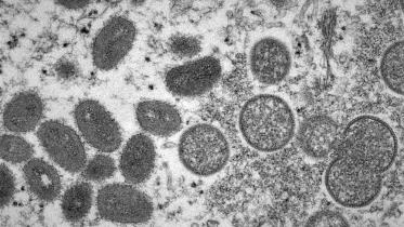 monkeypox death in India