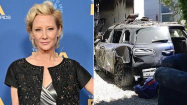 anne-heche-severely-burned-in-fiery-car-crash.jpg