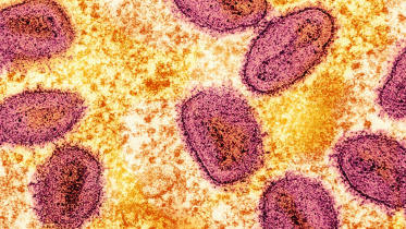 mpox-1.jpg