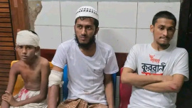 The injured were taken to Brahmanbaria 250-bed General Hospital and other hospitals. Photo: Collected