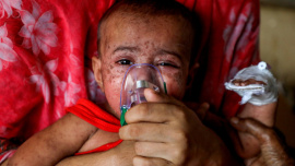 measles outbreak in Bangladesh.jpg