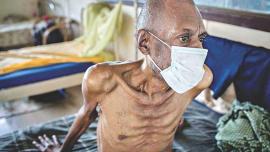 efforts-to-end-tb.jpg