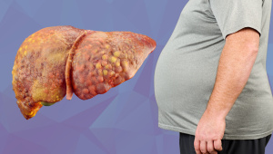 fatty-liver-disease.jpg