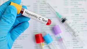 hepatitis_C.jpg