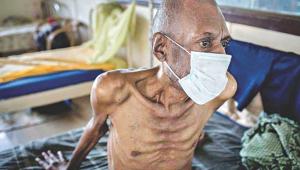efforts-to-end-tb.jpg