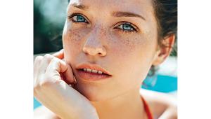 melasma-2.jpg