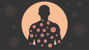 Mpox epidemic in Bangladesh 2024